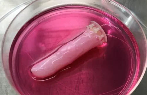 Robot finger with human-like skin in collagen Source: Shoji Takeuchi, University of Tokyo